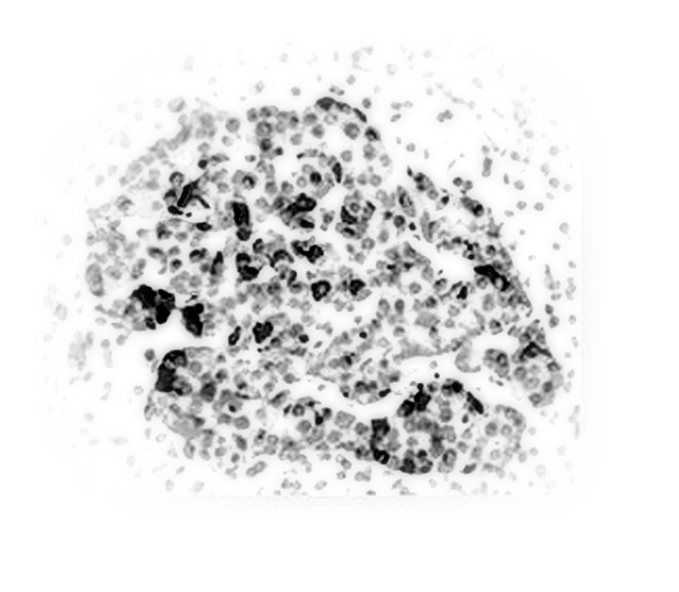 Confocal cross-section of a pancreatic islet